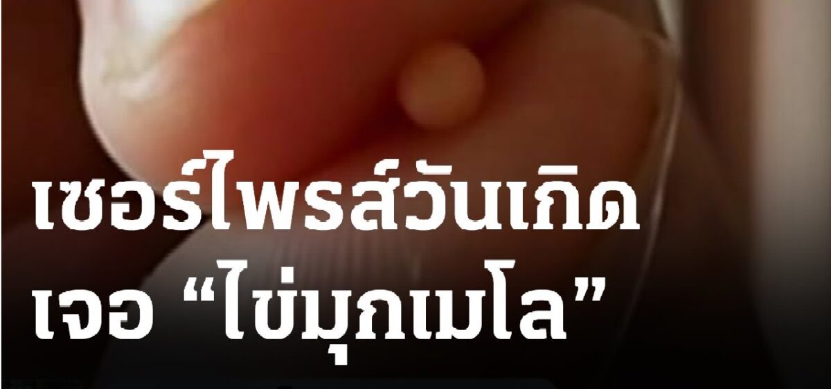 มุกเมโลให้โชค
