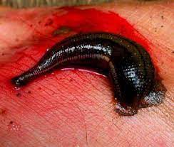 ปลิงดูดเลือด