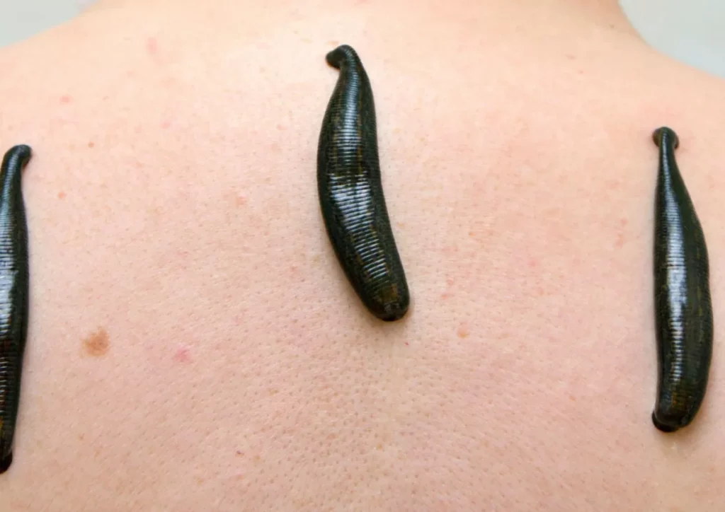 ฝันว่าปลิงเกาะ